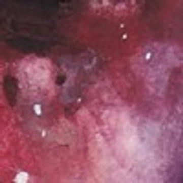 pearlchild - SYN (Exclusive)