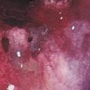 pearlchild - SYN (Exclusive)